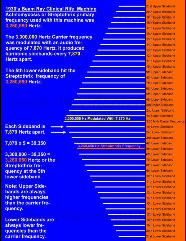 Streptothrix Sideband Chart